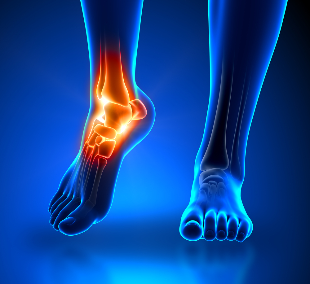 11 Reasons to See a Foot and Ankle Specialist ASAP Island Foot Clinics