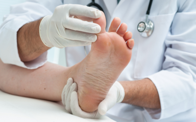 Will Athlete’s Foot Go Away on Its Own?