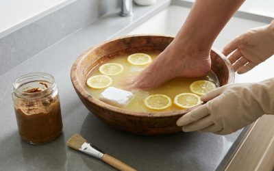 Warning: DIY Athlete’s Foot Treatments That Might Make It Worse in Surrey